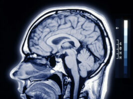 Brain402000x1500
