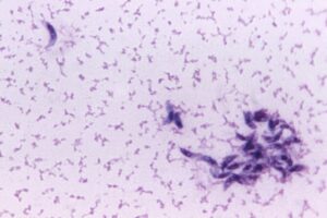 toxoplasmosis-gondii-cdc