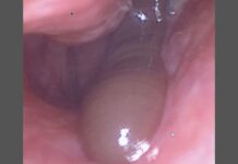 A Refreshing Mountain Rinse Left This Man With a Nose Leech and Days of Bleeding